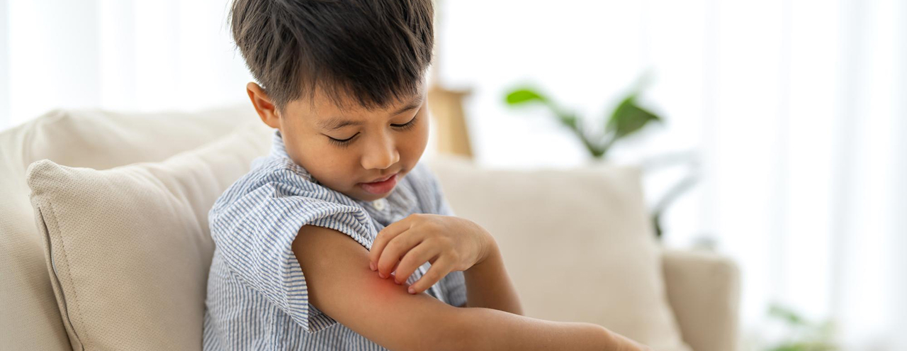 How to Protect Kids Skin (Ages 6–12) from Heat, Sweat & Rashes
